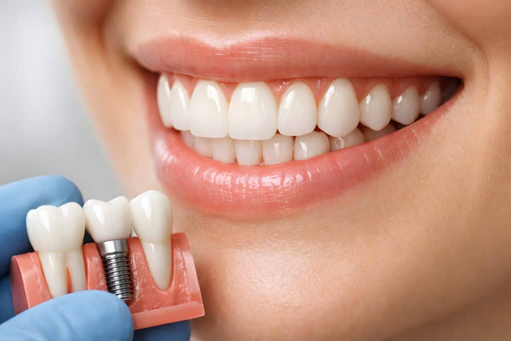 AdobeStock 1871550219 - Viera Dental Arts | Dentist in Melbourne FL Dental Implants, Close-Up of Healthy Teeth